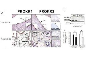 PROKR1 and PROKR2 protein expression in pacental-tissue, umbilical cord and in isolated HPECs and HUVECs (A) Immnohystoschemistry of chorionic vili and ombilical cord sections using antibodies to PROKR1 and PROKR2.