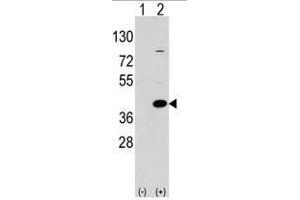 Image no. 1 for anti-Epilepsy, Progressive Myoclonus Type 2A, Lafora Disease (Laforin) (EPM2A) (C-Term) antibody (ABIN356954) (EPM2A anticorps  (C-Term))