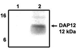 Image no. 1 for anti-TYRO Protein tyrosine Kinase Binding Protein (TYROBP) antibody (ABIN201720) (TYROBP anticorps)