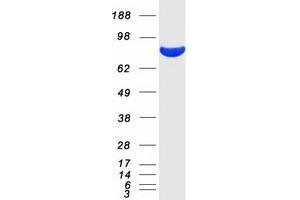 Validation with Western Blot