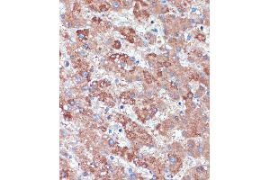Immunohistochemistry of paraffin-embedded Human liver using B3GNT3 Rabbit pAb (ABIN7271204) at dilution of 1:100 (40x lens).