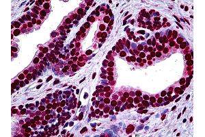 Anti-MEF2A antibody IHC of human prostate. (MEF2A anticorps  (AA 71-170))
