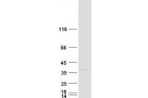 Validation with Western Blot