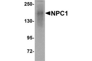 Western Blotting (WB) image for anti-Niemann-Pick Disease, Type C1 (NPC1) (C-Term) antibody (ABIN1030549) (NPC1 anticorps  (C-Term))