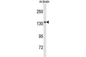 anti-Ubiquitously Transcribed Tetratricopeptide Repeat Gene, Y-Linked (UTY) (AA 1254-1284), (C-Term) antibody