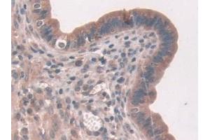 Detection of ASPN in Mouse Uterus Tissue using Polyclonal Antibody to Asporin (ASPN) (Asporin anticorps  (AA 16-373))