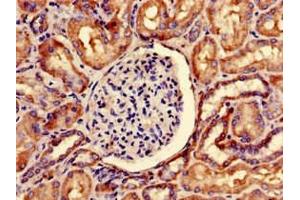 Immunohistochemistry of paraffin-embedded human kidney tissue using ABIN7169873 at dilution of 1:100 (SNRPD1 anticorps  (AA 1-119))
