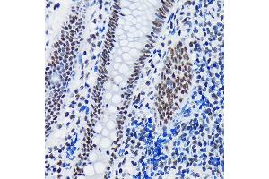 Immunohistochemistry of paraffin-embedded human appendix using SF3B1 Rabbit mAb (ABIN7270542) at dilution of 1:100 (40x lens). (SF3B1 anticorps)