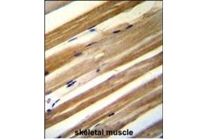 C antibody (C-term) (ABIN654725 and ABIN2844413) immunohistochemistry analysis in formalin fixed and paraffin embedded human skeletal muscle followed by peroxidase conjugation of the secondary antibody and DAB staining. (CU070 Protein anticorps  (C-Term))