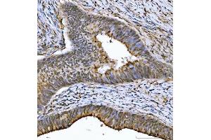 IHC analysis of THAP11 using anti-THAP11 antibody (ABIN7599230). (THAP11 anticorps  (AA 1-294))