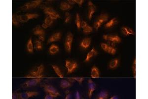 Immunofluorescence analysis of U-2 OS cells using SSTR2 Polyclonal Antibody at dilution of 1:100 (40x lens). (SSTR2 anticorps)