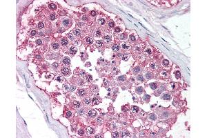 Anti-DAX1 antibody IHC of human testis.