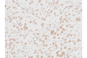 anti-Mediator Complex Subunit 12 (MED12) (AA 2127-2177) antibody