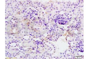 Formalin-fixed and mouse kidney tissue labeled with Anti-SOD2 Polyclonal Antibody, Unconjugated (ABIN737361) at 1:200 followed by conjugation to the secondary antibody and DAB staining