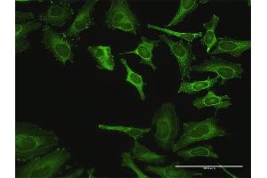 Immunofluorescence of purified MaxPab antibody to ZYX on HeLa cell. (ZYX anticorps  (AA 1-572))