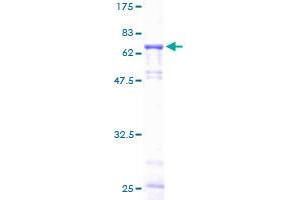 Image no. 1 for Galactosidase, alpha (GLA) (AA 1-429) protein (GST tag) (ABIN1355176)