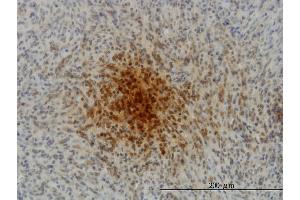 Immunoperoxidase of monoclonal antibody to MYL1 on formalin-fixed paraffin-embedded human spleen.