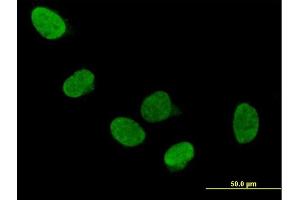 Immunofluorescence of purified MaxPab antibody to DDX5 on HeLa cell. (DDX5 anticorps  (AA 1-614))