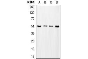 Western blot analysis of ADA2A expression in MCF7 (A), SP2/0 (B), H9C2 (C), mouse testis (D) whole cell lysates. (TADA2L anticorps  (Center))