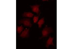 ABIN6267271 staining 293 by IF/ICC.