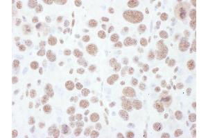 Immunohistochemistry (IHC) image for anti-Mitogen-Activated Protein Kinase Kinase 1 (MAP2K1) (pThr286) antibody (ABIN7453460)