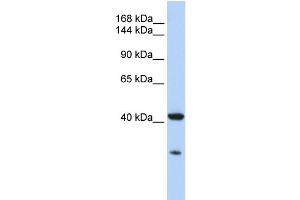 WB Suggested Anti-GNAS Antibody Titration:  1 ug/ml  Positive Control:  MCF-7 whole cell lysates GNAS is strongly supported by BioGPS gene expression data to be expressed in Human MCF7 cells