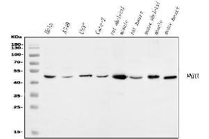 Western blot analysis of ENO3 using anti-ENO3 antibody (ABIN7602145).