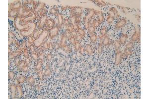 IHC-P analysis of Mouse Kidney Tissue, with DAB staining. (PLXNB1 anticorps  (AA 1598-1849))