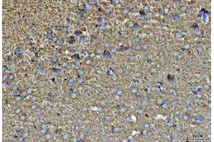 IHC analysis of SEPT7/SEPTIN7 using anti-SEPT7/SEPTIN7 antibody (ABIN7599301). (Septin 7 anticorps  (AA 1-351))