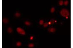 ABIN6274511 staining HuvEc cells by IF/ICC. (PRDM12 anticorps  (Internal Region))