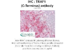Image no. 1 for anti-TNF Receptor-Associated Factor 1 (TRAF1) (C-Term) antibody (ABIN1740243) (TRAF1 anticorps  (C-Term))