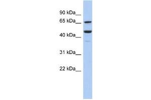 WB Suggested Anti-SF1 Antibody Titration:  0. (Splicing Factor 1 anticorps  (Middle Region))