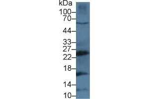 Detection of CTSG in Human MCF7 cell lysate using Polyclonal Antibody to Cathepsin G (CTSG)