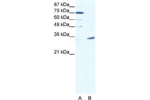 WB Suggested Anti-MAGEA9 Antibody Titration:  2. (MAGEA9 anticorps  (N-Term))