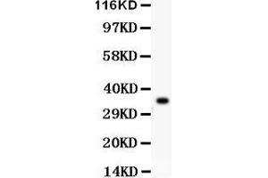 Anti- GPX1 antibody, Western blotting All lanes: Anti GPX1  at 0.