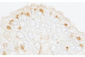 anti-Golgi Brefeldin A Resistant Guanine Nucleotide Exchange Factor 1 (GBF1) (AA 1809-1859) antibody