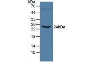 Detection of CRP in Human Serum using Monoclonal Antibody to C Reactive Protein (CRP)