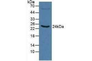 Detection of CRP in Human Serum using Monoclonal Antibody to C Reactive Protein (CRP) (CRP anticorps  (AA 20-225))