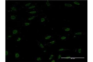 Immunofluorescence of monoclonal antibody to CRTC1 on HeLa cell.