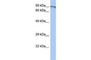 WB Suggested Anti-CXorf20 Antibody Titration: 0. (BEND2 anticorps  (Middle Region))