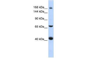 Western Blotting (WB) image for anti-ATP-Binding Cassette, Sub-Family C (CFTR/MRP), Member 9 (ABCC9) antibody (ABIN2458769) (ABCC9 anticorps)