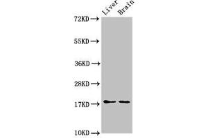 Western Blot Positive WB detected in: Mouse liver tissue, Mouse brain tissue All lanes: HSPB6 antibody at 3 μg/mL Secondary Goat polyclonal to rabbit IgG at 1/50000 dilution Predicted band size: 18 kDa Observed band size: 18 kDa (HSPB6 anticorps  (AA 1-160))