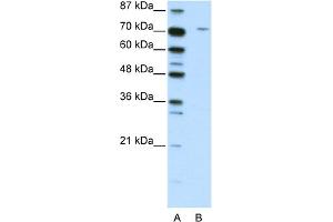 WB Suggested Anti-LZTS1 Antibody Titration:  2. (LZTS1 anticorps  (C-Term))