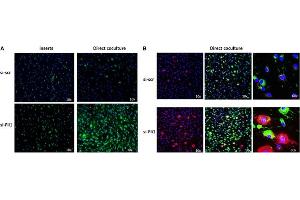 (A) Effects on collagen deposition in indirect (inserts) and direct coculture of human dermal fibroblasts and siRNA-treated THP1 cells.