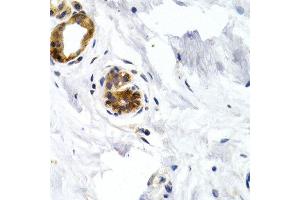 Immunohistochemistry of paraffin-embedded human normal breast using GDF5 antibody at dilution of 1:200 (400x lens). (GDF5 anticorps)