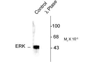 Image no. 1 for anti-MAPK1/2 (pThr202), (pTyr204) antibody (ABIN361504) (MAPK1/2 (pThr202), (pTyr204) anticorps)