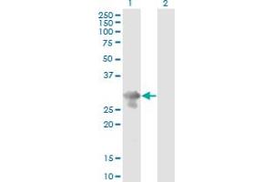 Western Blot analysis of PCGF5 expression in transfected 293T cell line by PCGF5 monoclonal antibody (M01), clone 3C10. (PCGF5 anticorps  (AA 51-148))
