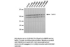 Image no. 1 for anti-Lamin A/C (LMNA) (Arg482Trp-Mutant) antibody (ABIN1042617) (Lamin A/C anticorps  (Arg482Trp-Mutant))