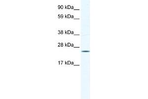 KCTD6 antibody used at 0. (KCTD6 anticorps  (N-Term))
