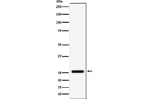 Western blot analysis of FADD expression in A431 cell lysate.